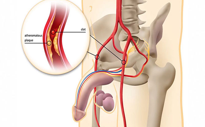 제이케이비티앤에스 - 비뇨기 관련 종양 질환 연구