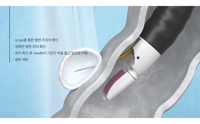 (주)파인메딕스 - 내시경용 국산화 의료기기