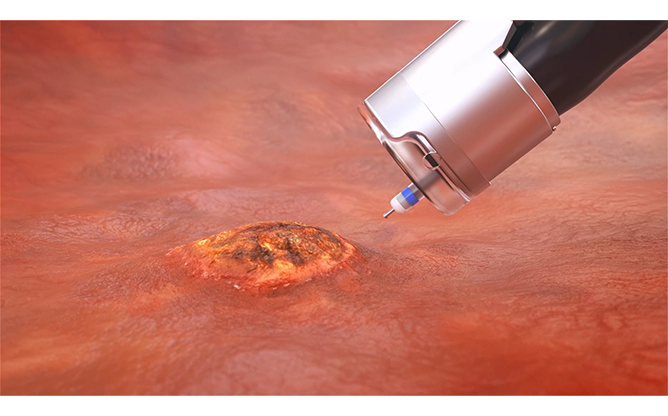 엔도로보틱스 주식회사 - 로즈 플랫폼 로봇팔