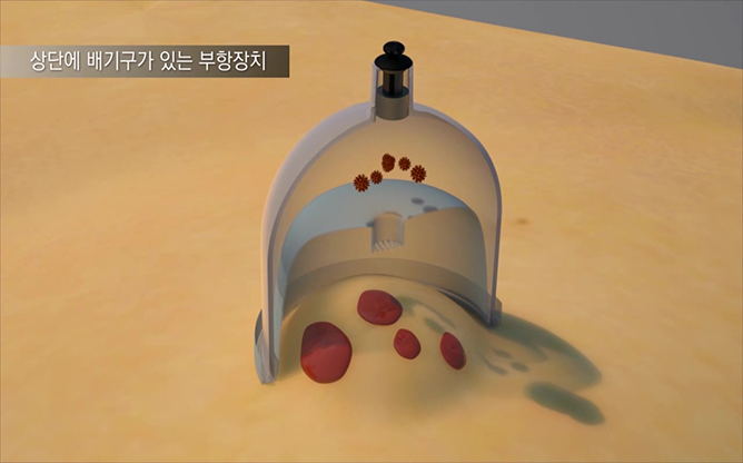 한국한의학연구원 - 일회용 멸균 부항장치