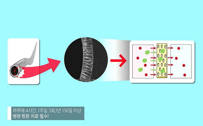 (주)이노셉 - 혈액투석 시스템 개발