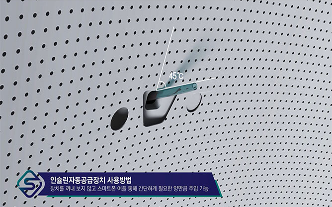 스팁 - 자동 인슐린 주입장치
