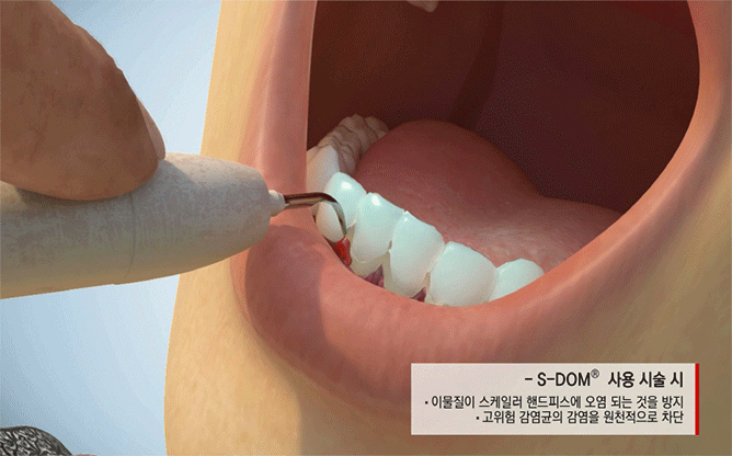 아폴로니아  - 치과의료기기 전문