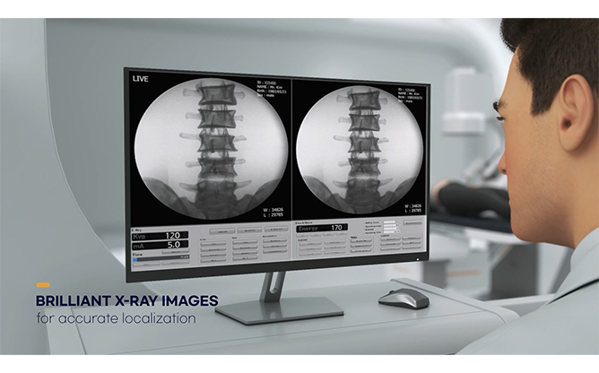 (주)휴온스메디텍 - 아사달