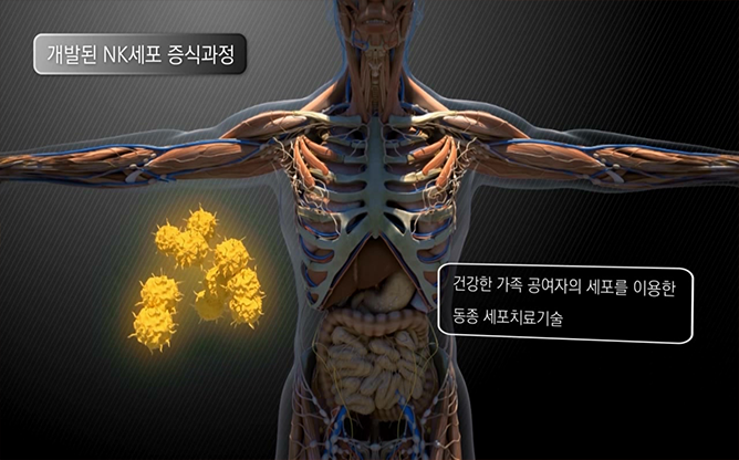 한국생명공학연구원 - 난치성암치료용NK세포