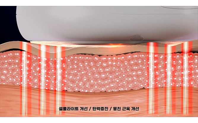 (주)일우전자 - 뷰티의료기기 전문 기업