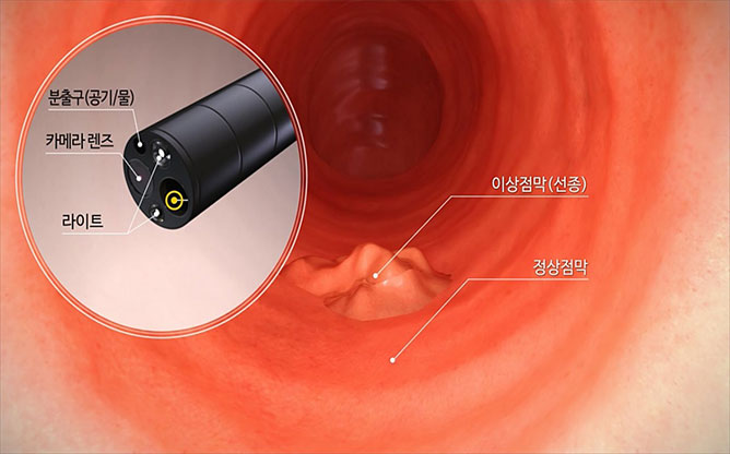 (주)옵티메디 - 의료기기