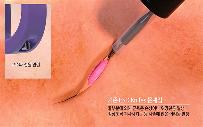 (주)옵티메디 - 의료기기