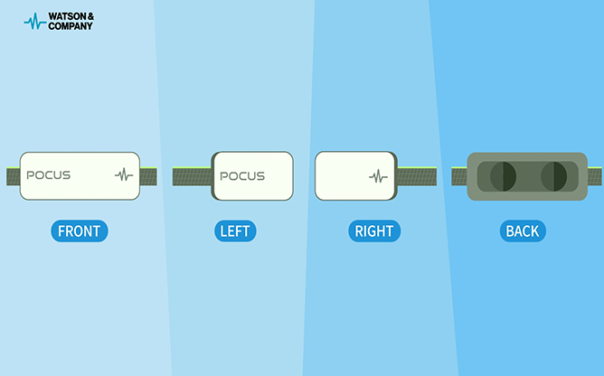 왓슨앤컴퍼니 - POCUS