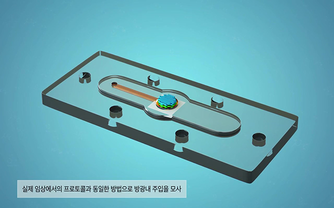 중앙대학교 - 방광암 치료
