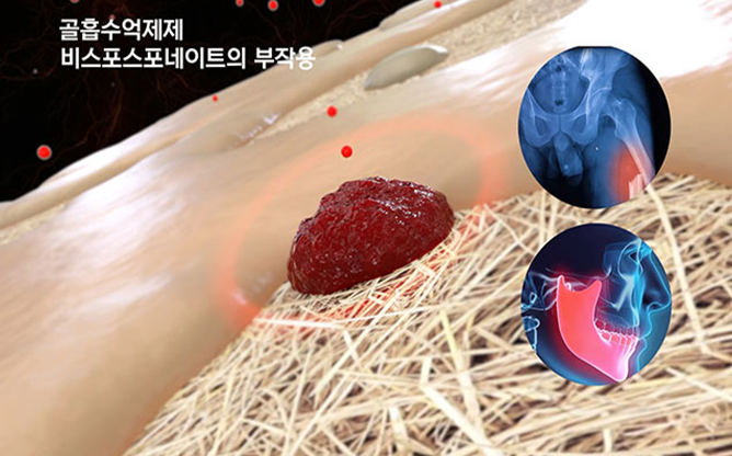 전남대학교 - 골다공증 치료용 저분자화합물