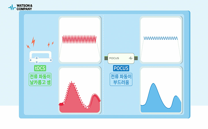왓슨앤컴퍼니 - POCUS