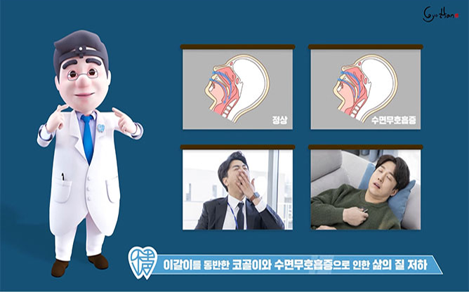 정덴탈 - 이갈이/코골이 방지 마우스피스