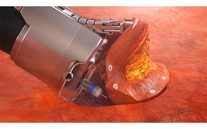 엔도로보틱스 주식회사 - 로즈 플랫폼 로봇팔