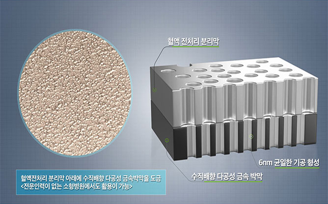 한국생산기술연구원 - 혈액전처리분리막