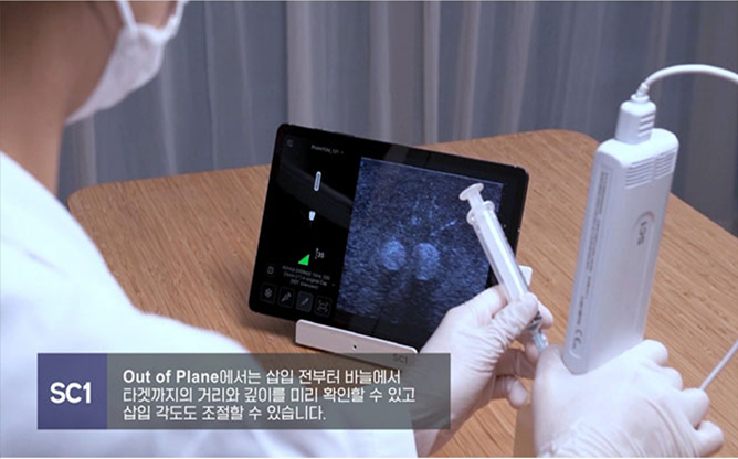 (주)에프씨유 - 초음파의료기기