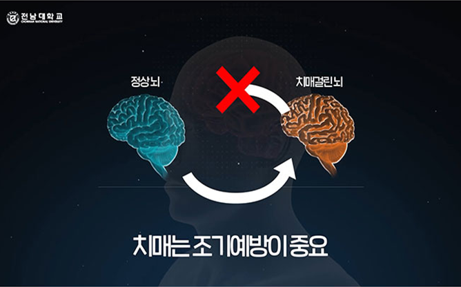 전남대학교 - 귀리 추출물 기반 치매 예방 기술