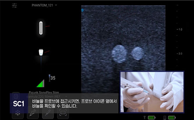 (주)에프씨유 - 초음파의료기기