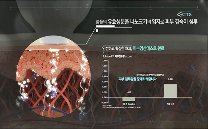 (주)제이티에스인더스트리 - 레이저의료기기 전문
