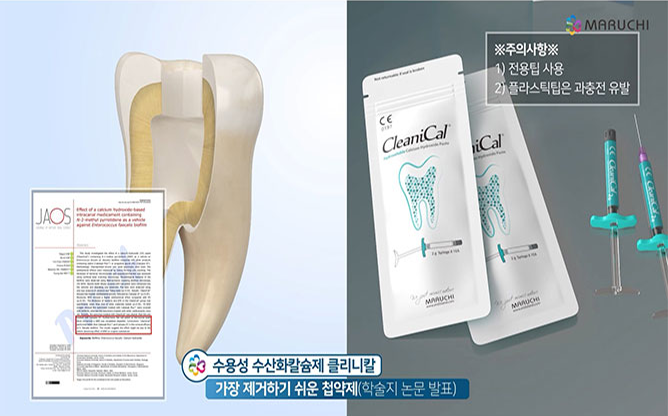 주식회사 마루치 - 최소침습 근관치료 가이드