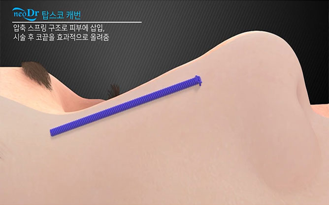 (주)네오닥터 - 의료기기