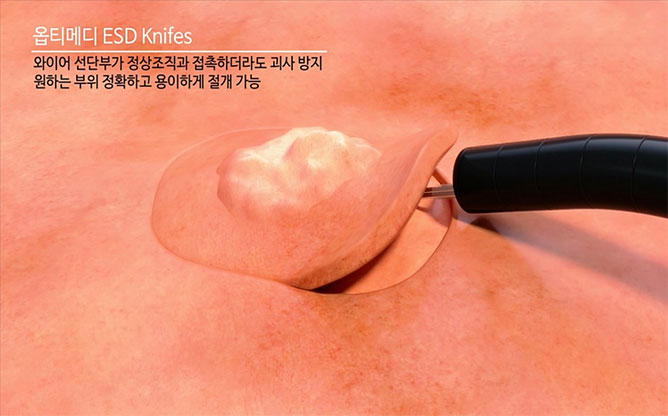 (주)옵티메디 - 의료기기