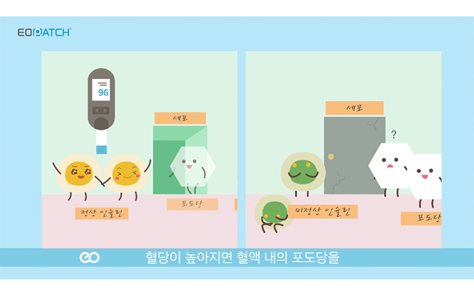 이오플로우 - 체외용 인슐린 주입기