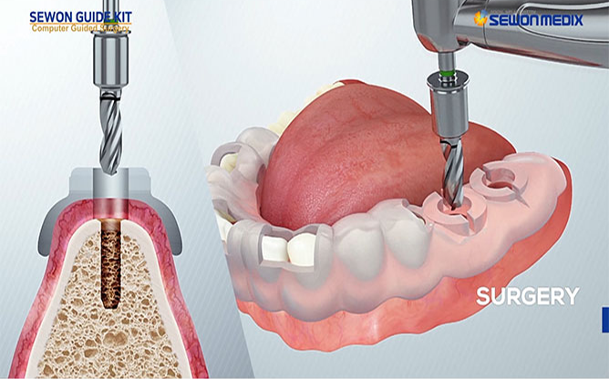 (주)세원메딕스 - Surgical kit