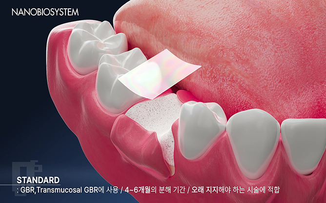 주식회사 나노바이오시스템 - 조직재생지지체