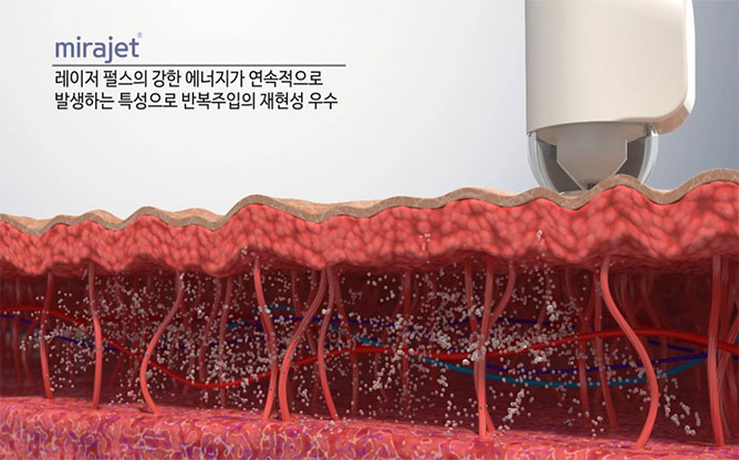 (주)JSK바이오메드-약물전달시스템