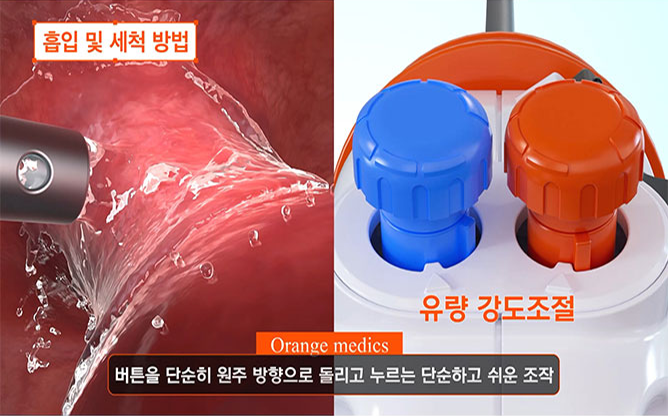 (주)오렌지메딕스 - 압력조절전기흡인세척기