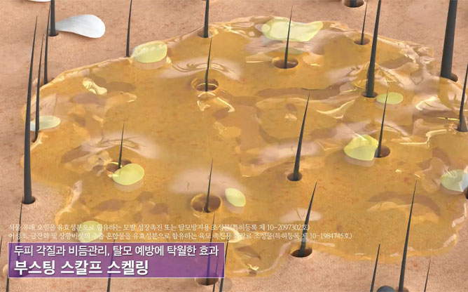 (주)하이솔 - 두피 셀프케어솔루션