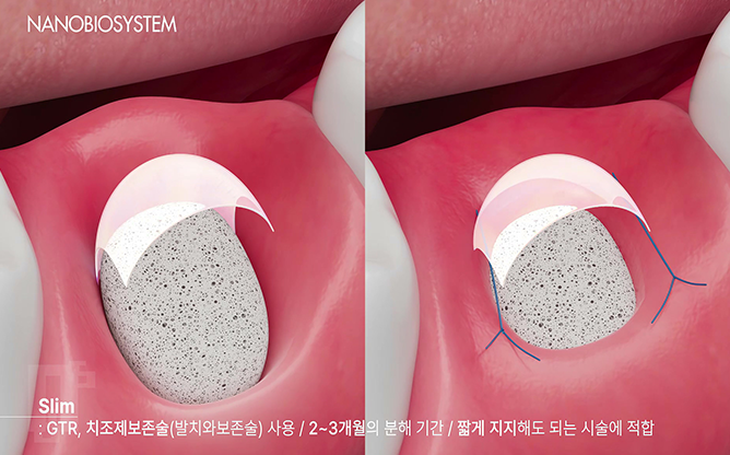 주식회사 나노바이오시스템 - 조직재생지지체