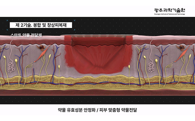 광주과학기술원 - 광치료재생의학 연구단