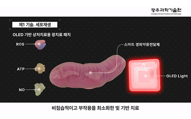 광주과학기술원 - 광치료재생의학 연구단