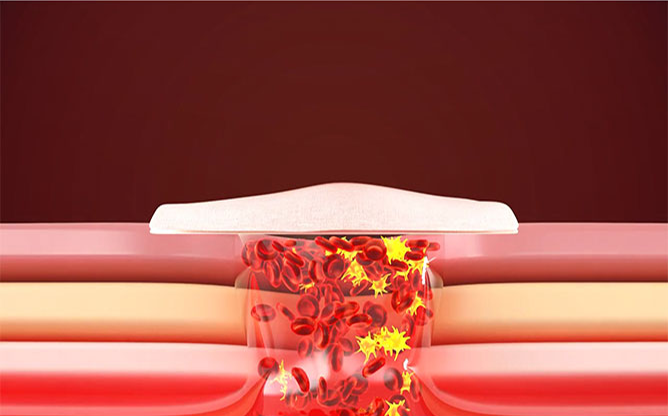 (주)엔도비전 - BIO MATERIAL KIOMER M3