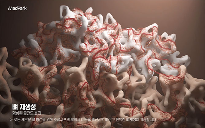 (주)메드파크 - 치과용 골이식재