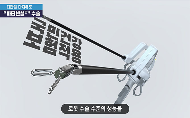 (주)리브스메드 - 복강경 수술기구