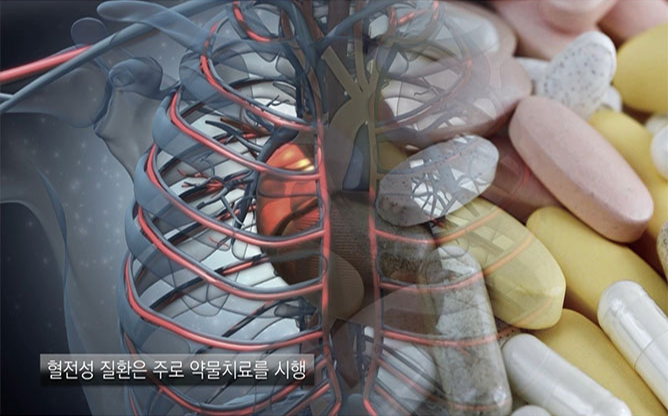 한국한의학연구원 - 관중추출물