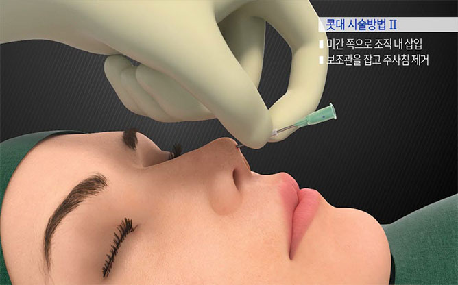 (주)네오닥터 - 의료기기