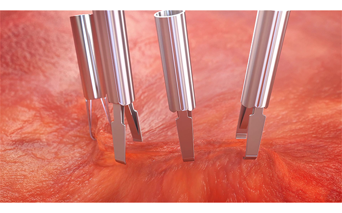 엔도로보틱스 주식회사 - 로즈 플랫폼 로봇팔