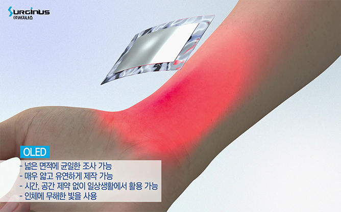 카이스트 - 광치료 패치 전자약