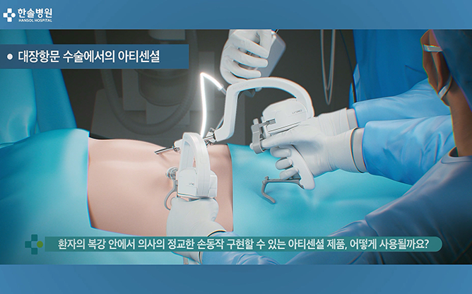 리브스메드 - 복강경 수술기구