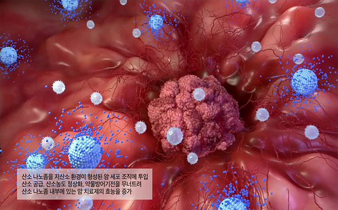 중앙대학교 - 나노버블 약물전달체 기술