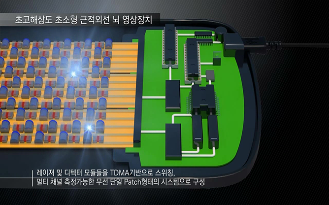 카이스트 - 초고해상도 초소형 뇌 영상장치