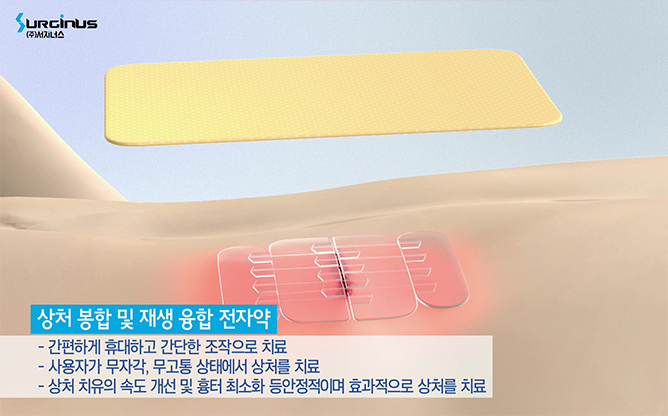 카이스트 - 광치료 패치 전자약