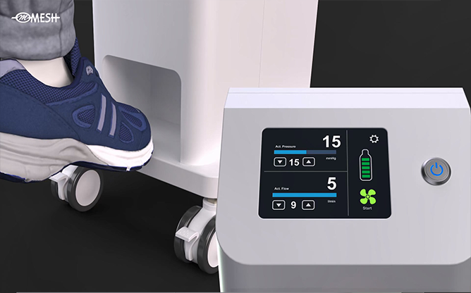 메쉬 - CO2 Insufflator