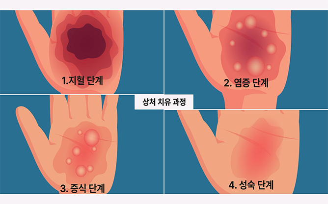 광주과학기술원 - 광치료재생의학