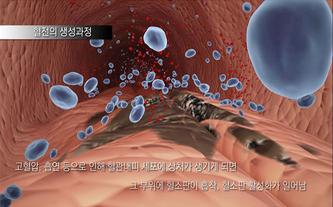 한국한의학연구원 - 관중추출물