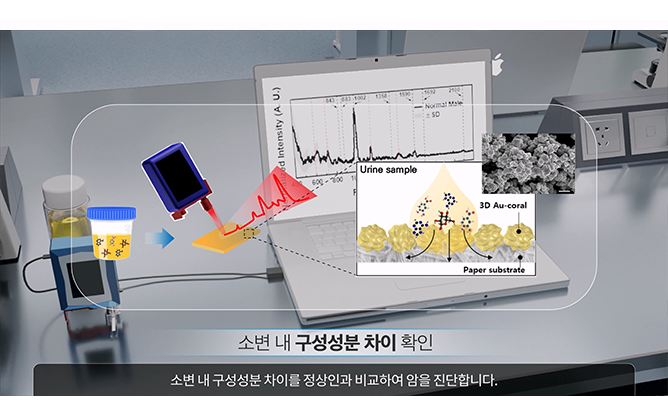 한국재료연구원 - 암검진 시스템